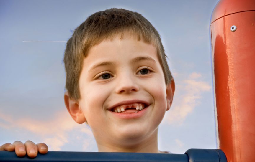 niño sin dientes